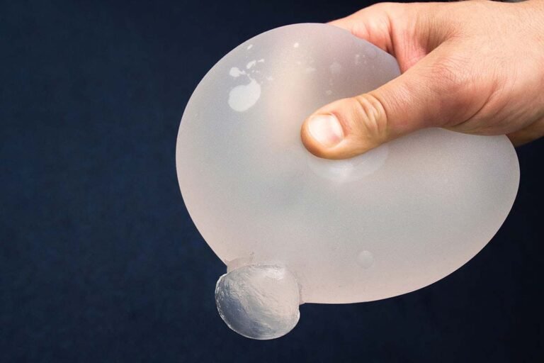 inflammation from breast implants