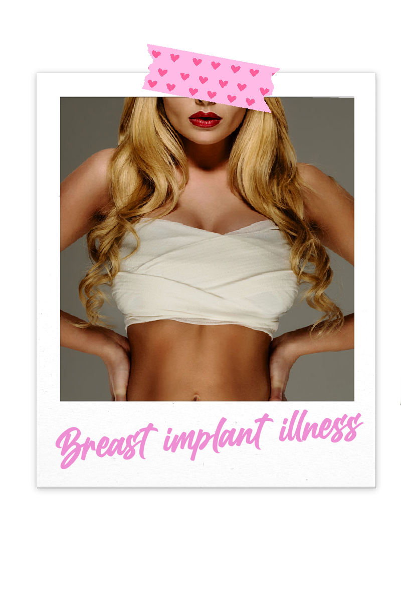 symptoms of Breast Implant Illness
